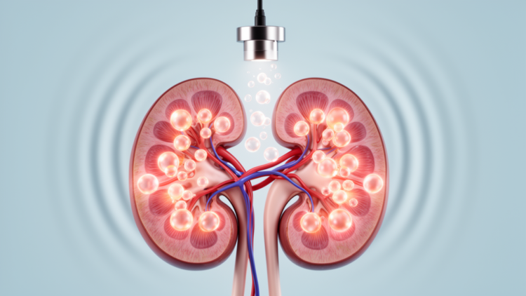 Gentle Ultrasound and Microbubbles Repair Diabetic Kidney Damage in Mice