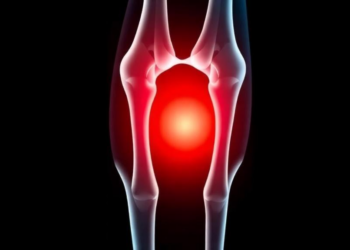 New Risk Score Outperforms KLIC in Predicting Failure of Implant-Sparing Surgery for Joint Infections