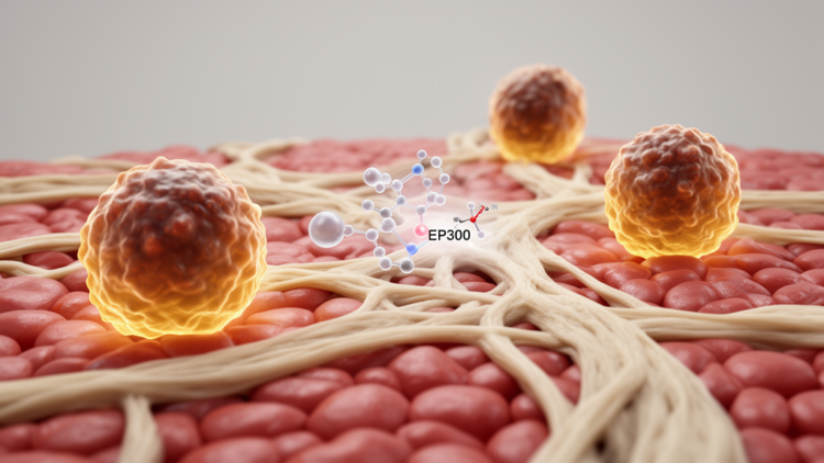 Blocking EP300 Rewires Scar-Associated Macrophages to Fight Acute Liver Failure