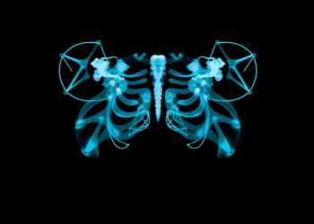CNN or Transformer? AI Duel Reveals Best Way to Read X-ray Patterns