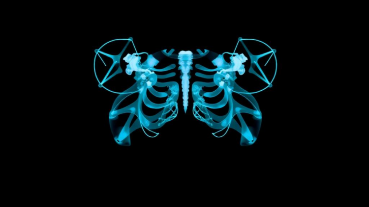 CNN or Transformer? AI Duel Reveals Best Way to Read X-ray Patterns