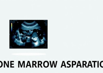 Ultrasound Takes the Guesswork Out of Bone Marrow Aspiration