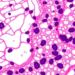 AI Reads the Endometrium: Foundation Models Predict IVF Success from Tissue Slides