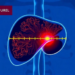 How Measurement Errors Could Undermine the 5-Millimeter Rule in Liver Cancer Ablation