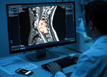 AI Reads the Neck’s Deadliest Plaques, but the Clinic Isn’t Ready Yet