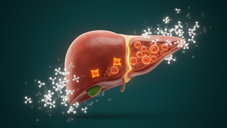 Stevia Extract Shields Diabetic Livers by Taming Iron-Driven Cell Death