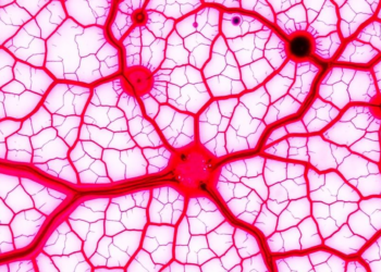 Blood Vessel Patterns Under the Microscope Reveal Which Sebaceous Skin Tumors Turn Deadly