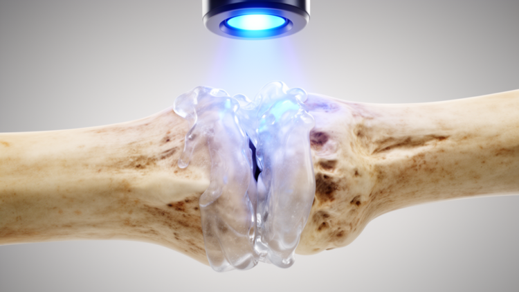 Light-Cured Bone Glue That Mimics Natural Bone Mineral Speeds Fracture Healing
