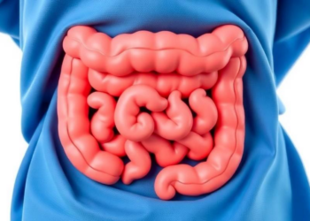 Bowel Dysfunction After Rectal Cancer Surgery Splits Into Three Distinct Symptom Domains, Study Finds