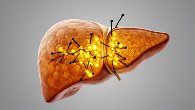 Turmeric Compound and Black Pepper Molecule Team Up to Block Liver Cancer in Rats