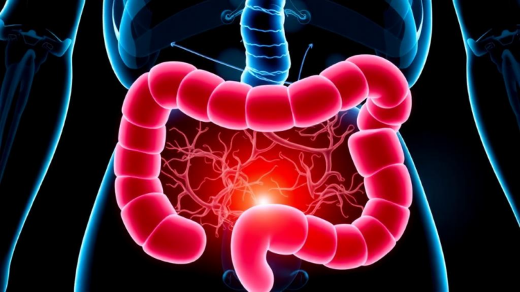 Two Probiotic Strains Calm Gut Inflammation by Taming the NLRP3 Inflammasome