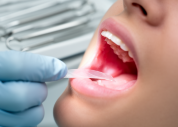 Dissolvable Gum Film Delivers Next-Generation Antibiotic Straight Into Periodontal Pockets
