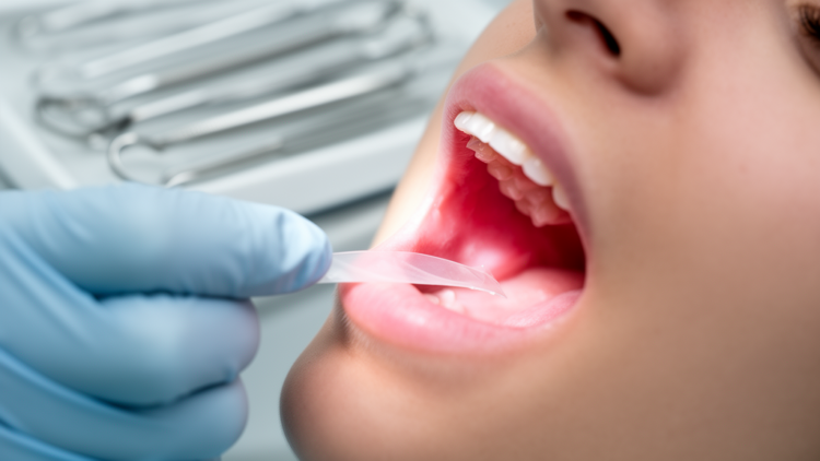 Dissolvable Gum Film Delivers Next-Generation Antibiotic Straight Into Periodontal Pockets