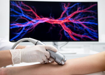 Handheld probe, full picture: dual-feature SLAM builds panoramic 3D vascular maps