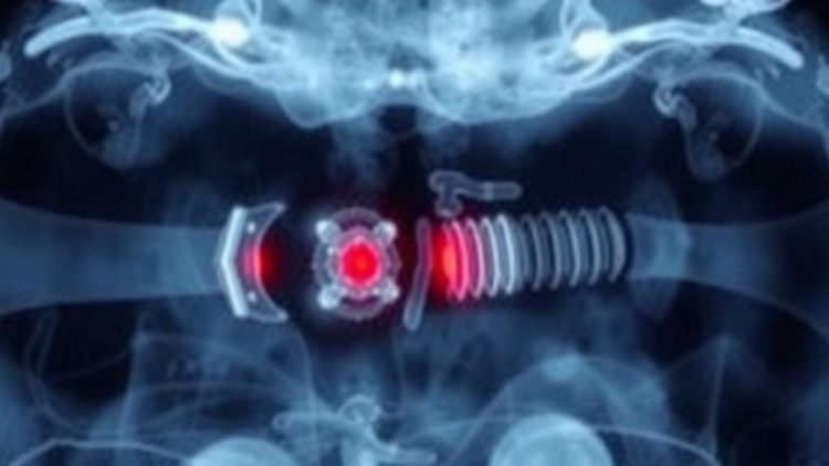 Ultrasound-Shaken Implants Reveal Hidden Bone Infection Pathogens