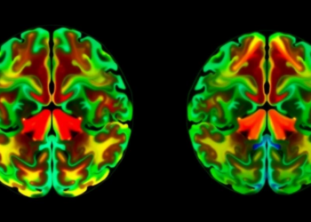 Thalamus Brain Maps Reveal Two Distinct Schizophrenia Biotypes