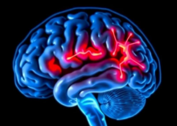 Brain Scan Fingerprints of Parkinson’s Emerge Years Before Symptoms Appear