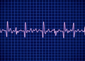AI Turns a Routine ECG Into a Powerful Predictor of Hidden Heart Artery Disease
