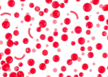 When Platelet Counts Soar Past a Million, Hematologists Split on How to Act