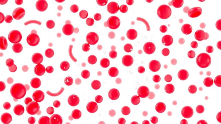 When Platelet Counts Soar Past a Million, Hematologists Split on How to Act