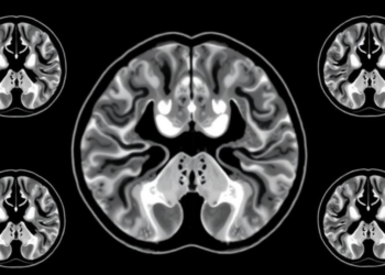 MRI Radiomics Model Predicts Survival in Colorectal Cancer With Liver Metastases