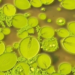 Algal Blooms Are Quietly Draining Carbon From Lake Sediments, Study Warns