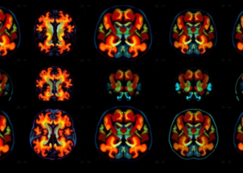 Brain Scans Reveal Why Some Mice Break Under Stress While Others Bounce Back