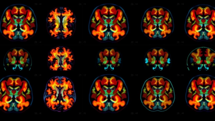 Brain Scans Reveal Why Some Mice Break Under Stress While Others Bounce Back